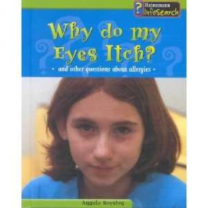  Why Do My Eyes Itch? Angela Royston Books