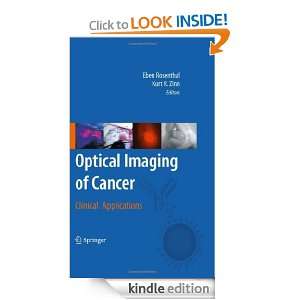 Optical Imaging of Cancer Clinical Applications Eben Rosenthal, Kurt 