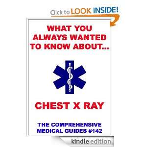 What You Always Wanted To Know About Chest X Ray Various Authors 